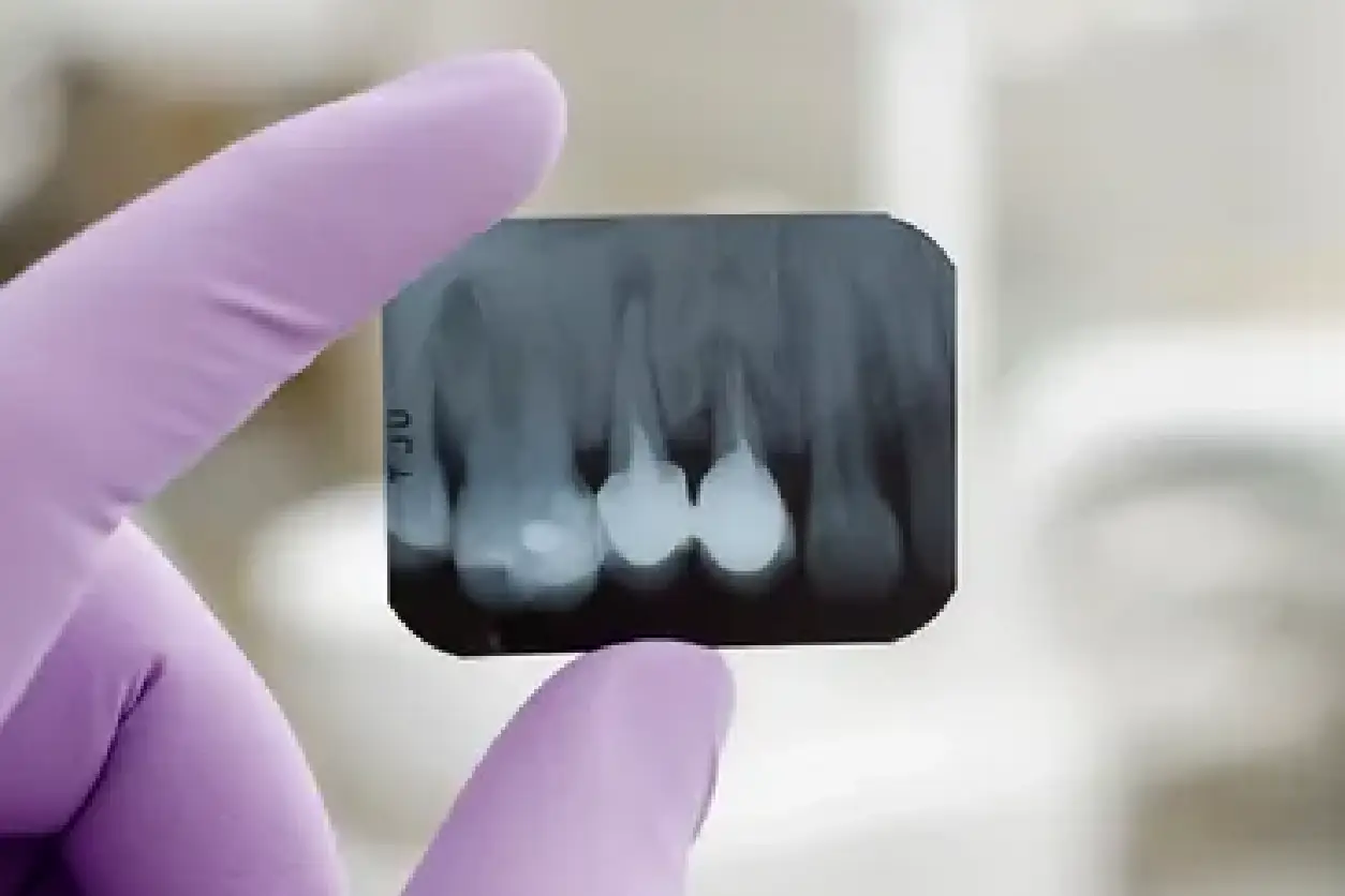 A person holding an x-ray of teeth.